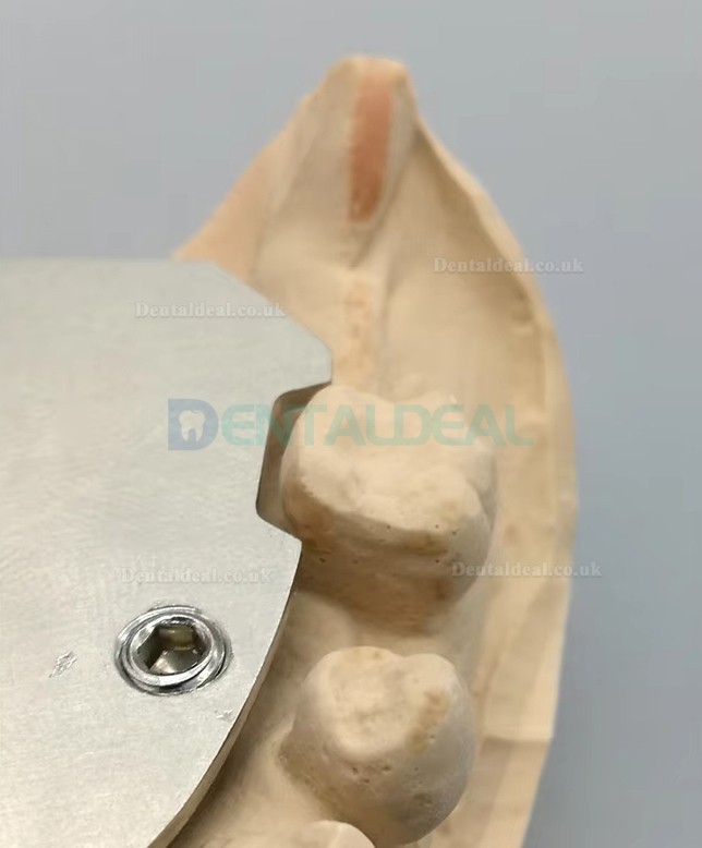 Dental Gothic Arch Tracer for Vertical Centric Recording